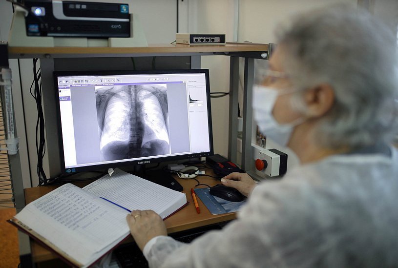 Врач-рентгенолог смотрит на экран на котором отображаются легкие пациента 