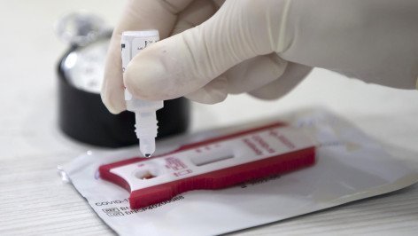 Тест на COVID-19 